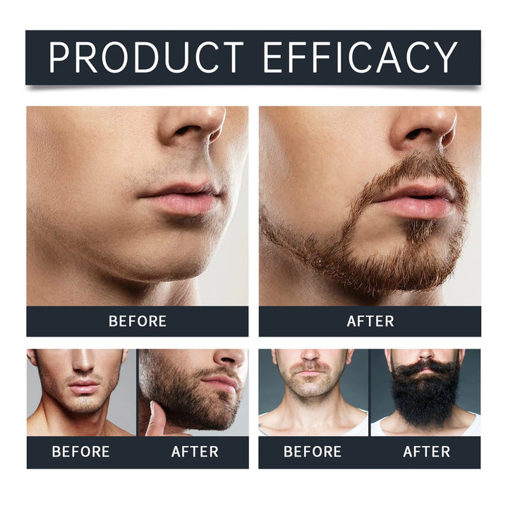 East Moon Men Beard Care Set for Cleaning Strengthen Nourishing Beard Promote Beard Growth Moisturizing Men Whisker Care Set