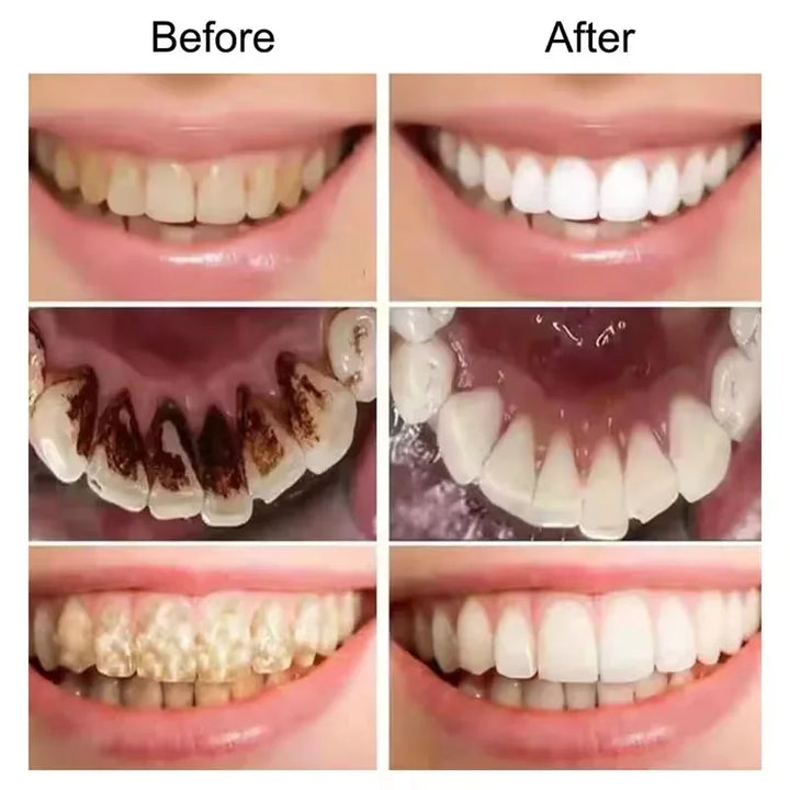 V34 Purple Teeth Whitening Toothpaste Remove Plaque Stains