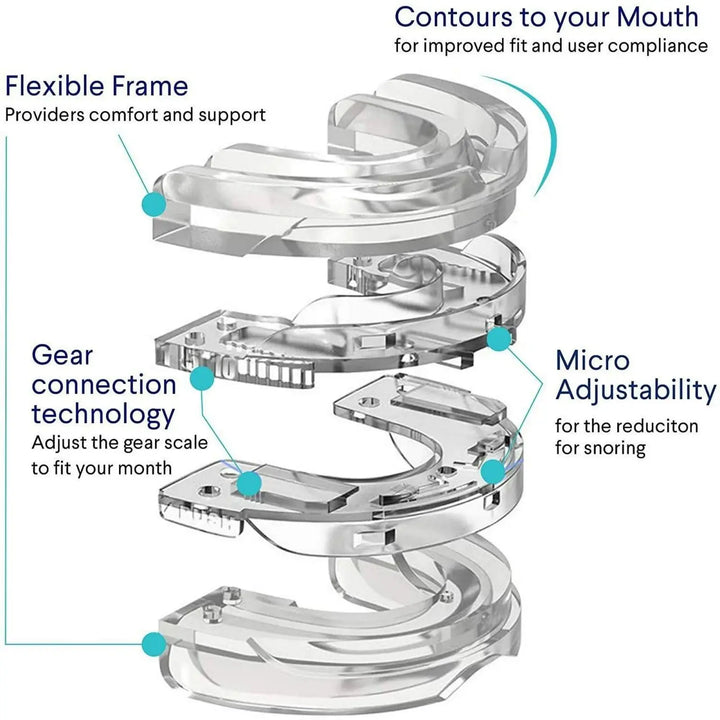 QuietNight™ Sleep Mouthpiece